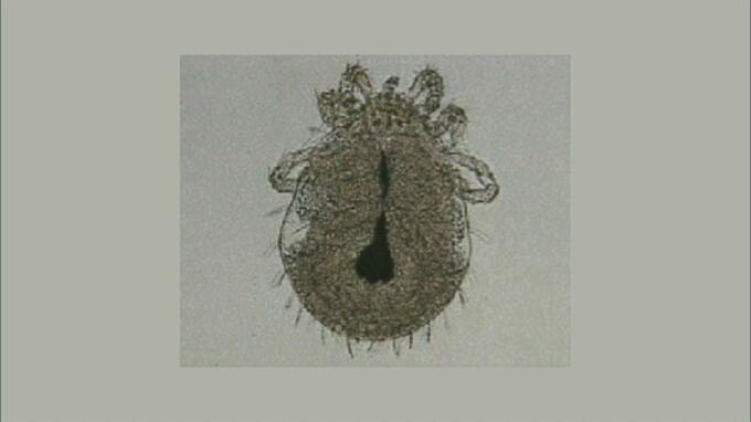 60代男性が“ツツガムシ病”と診断　予防対策や医療機関の早期受信を心掛けるように注意を呼び掛け　青森県　死に至るケースもある“ツツガムシ病”とは？症状や予防対策は？　|　青森のニュース│ATV NEWS│青森テレビ