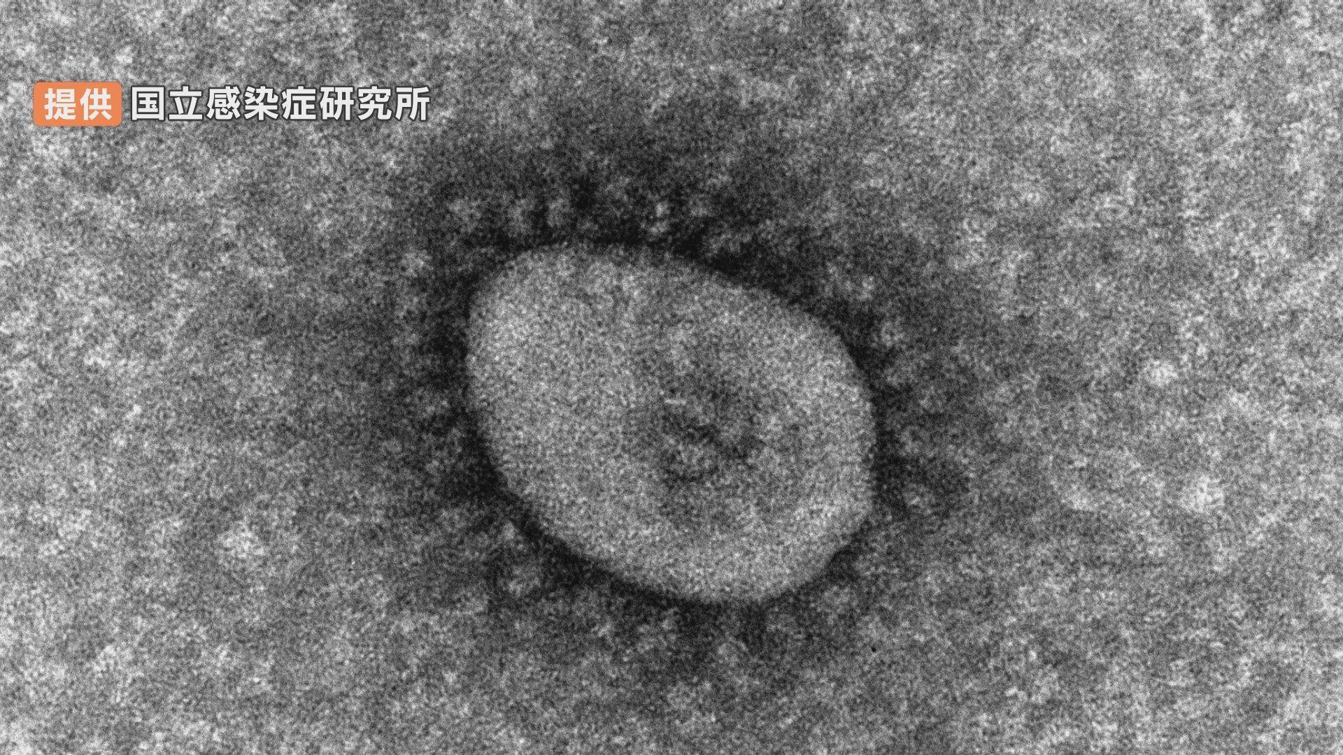 速報値 新型コロナ 愛媛県内で新たに300人以上の感染確認 先週月曜を100人ほど下回る見通し Tbs News Dig
