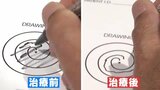 高度な医療サービスを受けるため日本へ 外国人の需要が高まる「医療ツーリズム」 超音波を脳に照射する最新治療を受ける中国人男性に密着 【チャント!大石が聞く】 | 名古屋・愛知・岐阜・三重のニュース【CBC news】 | CBC web