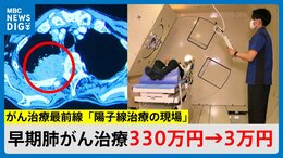 早期肺がん治療費330万円が3万円に　陽子線治療が今月から保険診療に「大きかったので治るか心配したが、もう6年生存」【がん治療最前線】|TBS NEWS DIG