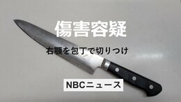 知人女性の”顎” 包丁で切りつけた疑い　24歳の男逮捕　病院関係者の通報で事件発覚 長崎県壱岐市|TBS NEWS DIG