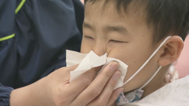 東海地方で花粉大量飛散 3歳の男の子は花粉症が原因で中耳炎にも 「ことしは乾燥していて“いつもよりイガイガする”という人多い」|TBS NEWS DIG