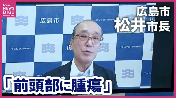 【会見全文】広島市の松井一実市長「悪性の脳腫瘍」とリモート会見で病状明かす　リモート協議など執務従事は可能　来春の市長選出馬にも引き続き意欲【会見全文】|TBS NEWS DIG