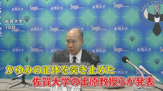 アトピー性皮膚炎のかゆみの正体を解明　新薬開発にも期待　10年以内に【まるっと！サタデー】|TBS NEWS DIG