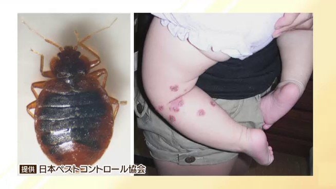 韓国で問題『トコジラミ』、大阪では真偽不明の「谷町線にトコジラミ」複数SNS投稿受け1380車両を順次清掃する事態　専門家は「旅の外泊先でも注意を！」|TBS NEWS DIG