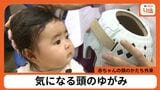 あおむけ寝推奨で増えている? 赤ちゃんの頭のゆがみ 「頭のかたち外来」とは 那覇市立病院が開設 | 沖縄のニュース|RBC 琉球放送