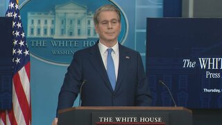 ベッセント財務長官「円は過小評価されている」 異例の発言で過度な円安容認しない姿勢| TBS CROSS DIG with Bloomberg