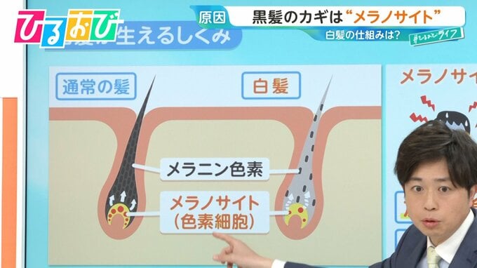 白髪「抜くと増える」「ワカメを食べると黒くなる」は本当？素朴なギモンを髪のプロに聞く【ひるおび】|TBS NEWS DIG