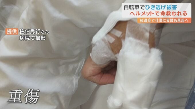 「指がぶら下がった状態、ちぎれたかと…」自転車で走行中に車にはねられ重傷 ヘルメット着用で一命とりとめるも握力は10キロ　|　愛媛のニュース - Nスタえひめ｜あいテレビは6チャンネル