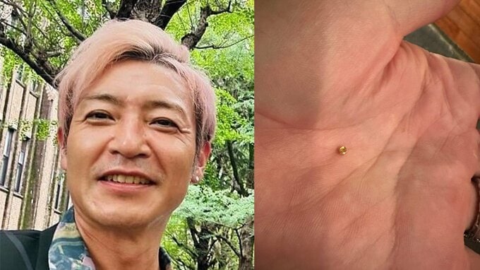 【つるの剛士】　　サラダから謎の“金色のナット”発見 「自分のどこのボルトが外れたんやろ」と困惑|TBS NEWS DIG