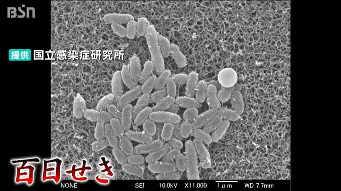 30代・40代も要注意『百日せき』 乳幼児は感染すると最悪死亡するケースも…  新潟県では感染が急増|TBS NEWS DIG