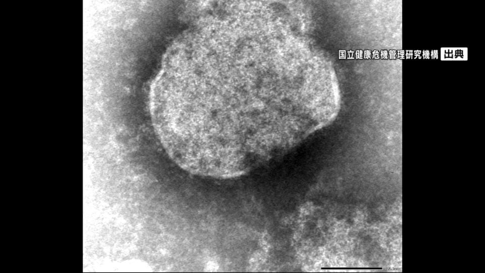 沖縄でことし2例目のはしか感染を確認　26日に航空機→那覇空港→タクシー利用　現在は体調回復傾向