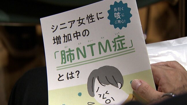 【長引く咳や痰を引き起こす肺の病気】中高年の女性を中心に患者が増加　まだ認知度が低い「肺NTM症」と呼ばれる「肺非結核性抗酸菌症」と「気管支拡張症」|TBS NEWS DIG