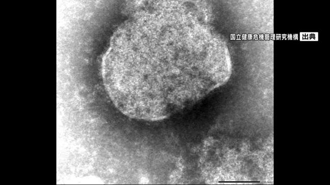 沖縄でことし2例目のはしか感染を確認　26日に航空機→那覇空港→タクシー利用　現在は体調回復傾向|TBS NEWS DIG