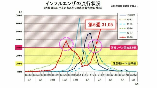 【速報】インフルエンザ　今シーズン2回目の警戒レベル超え　大阪で調査開始以降初めて　今回はB型流行の見込み|TBS NEWS DIG