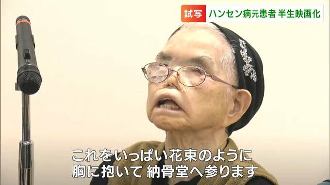 国立ハンセン病療養所・長島愛生園で暮らす96歳女性の日々　映画「かづゑ的」宮崎かづゑさんの思い　|　岡山・香川のニュース | 天気 | RSK山陽放送