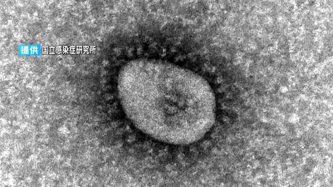 新型コロナ感染者　先週の1.4倍　専門家「高齢者を守るため感染対策を」|TBS NEWS DIG