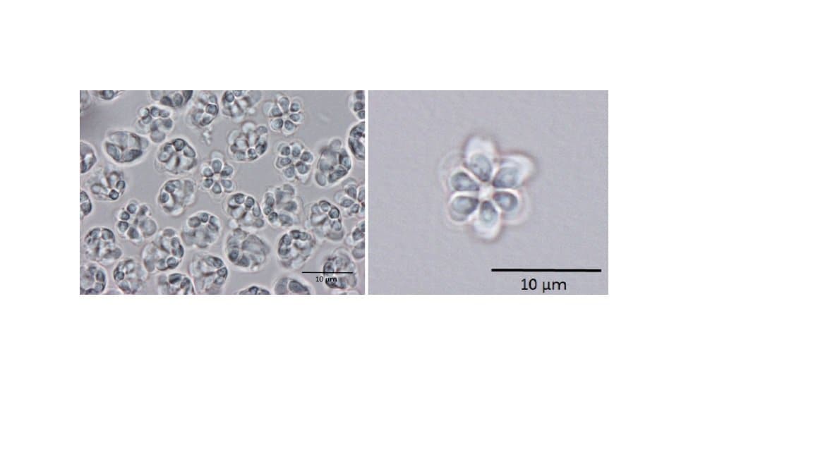 アニサキスより小さな寄生虫「クドア」による食中毒 スーパーで購入