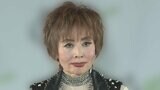 小柳ルミ子さん 「最悪の結果」 骨折していた右手の指を「もう一度 折って 正しい位置にはめる」「初めてです 骨が折れる音を聞いたのは」|TBS NEWS DIG
