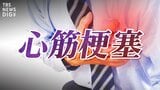 【心筋梗塞】“肩こり”もサイン!?日本人の死因第2位 胸の痛みだけじゃない「心筋梗塞」の兆候|TBS NEWS DIG