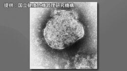 【速報】はしか感染者数　今年200人超える　去年同時期の3倍以上　感染経路は「国内」が63％で最多　感染者は10代が最も多い|TBS NEWS DIG