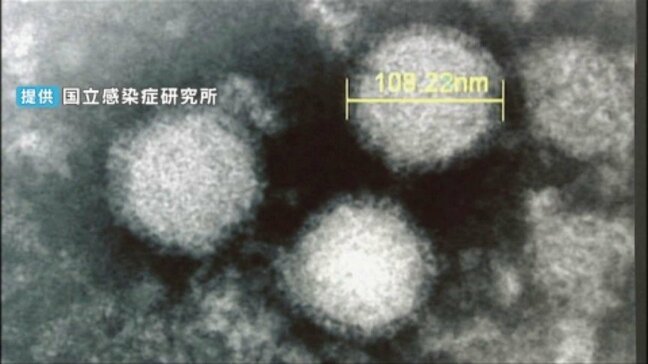 愛媛で今年初の「SFTS」確認 宇和島保健所管内の70代女性が感染|TBS NEWS DIG