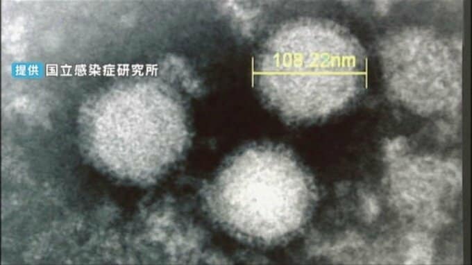 愛媛で今年初の「SFTS」確認 宇和島保健所管内の70代女性が感染|TBS NEWS DIG