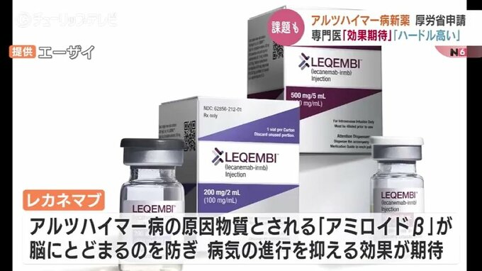 アメリカでは薬剤費350万円　“画期的”認知症新薬に現場の医師は？期待の一方「血管から出血」の心配も　富山　|　富山のニュース｜天気・防災｜チューリップテレビ