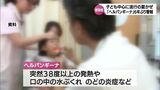 子ども中心に流行する夏風邪「ヘルパンギーナ」 6年ぶりに宮崎県内で警報レベル超える 新型コロナ前週比1.43倍 インフルエンザ前週比1.56倍 | MRTニュース | MRT宮崎放送