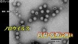 ”冬の食中毒”ノロウイルス拡大 2か月生存し脅威の感染力 おう吐すると部屋にはウイルスの粒子が…ポイントは「いかに広げないようにするか」 富山|TBS NEWS DIG