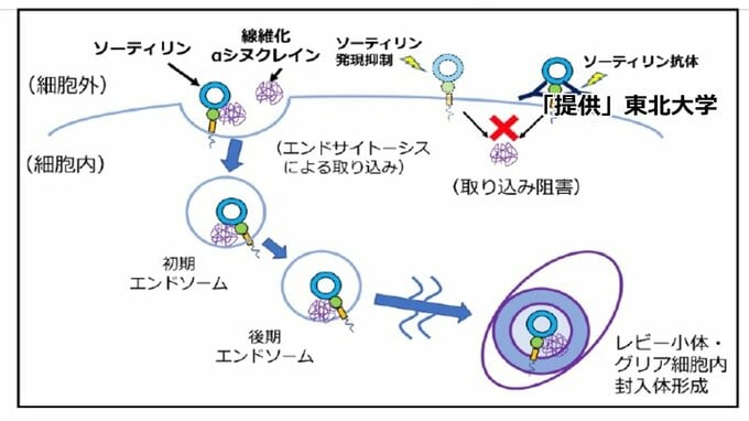 パーキンソン病発症の仕組み解明と東北大が発表　ソーティリンというタンパク質がαシヌクレインを細胞内に取り込み蓄積　進行抑制治療薬開発にも期待|TBS NEWS DIG