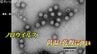 ”冬の食中毒”ノロウイルス拡大　２か月生存し脅威の感染力　おう吐すると部屋にはウイルスの粒子が…ポイントは「いかに広げないようにするか」　富山　|　富山のニュース｜天気・防災｜チューリップテレビ