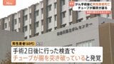 神奈川県立がんセンターで手術を受けた患者が死亡 栄養剤を送るために付けたチューブが腸を突き破る 医療ミスがあったか調査|TBS NEWS DIG