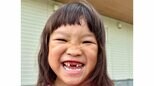【ののちゃん】　「給食の時間に抜けた歯を、なくさないようにと手で握りしめて帰ってきました」 上の前歯が抜けたことを報告|TBS NEWS DIG