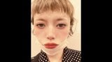 【広田レオナ】 「変形性股関節症で去年の暮れには部分的に壊死」 手術予定もインフルA型で仕切り直しに|TBS NEWS DIG