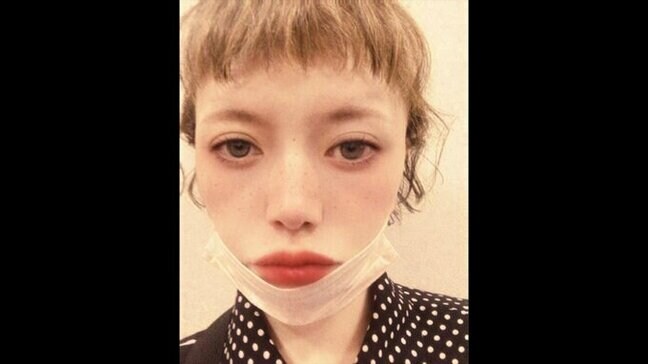 【広田レオナ】 「変形性股関節症で去年の暮れには部分的に壊死」 手術予定もインフルA型で仕切り直しに|TBS NEWS DIG