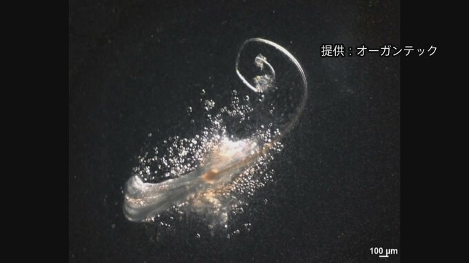 毛包に必要な「第三の細胞」発見し生体外で髪の毛の再生に成功と発表　理研などの共同研究チーム|TBS NEWS DIG