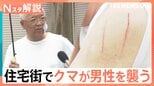 「後ろに押し倒され…」住宅街でクマに襲われた男性が語る恐怖の瞬間【Nスタ解説】|TBS NEWS DIG