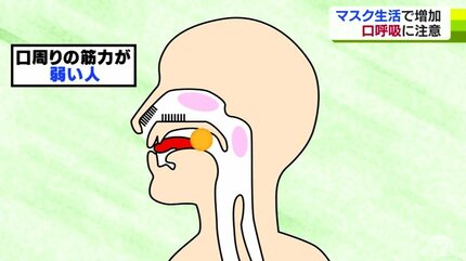 マスク生活で増加！「口呼吸」に注意 感染症・虫歯のリスクが高まる
