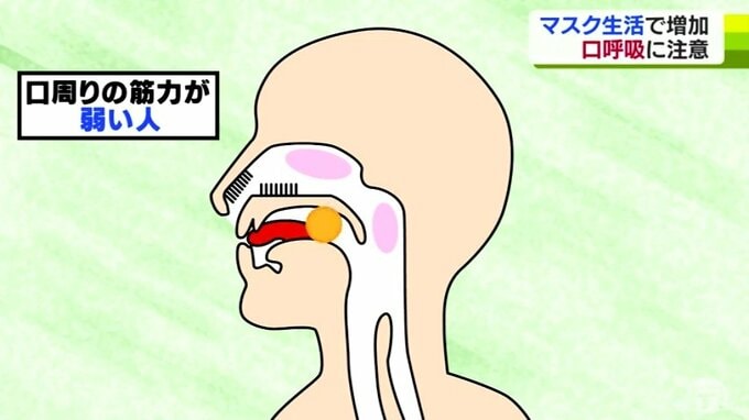マスク生活で増加！「口呼吸」に注意　感染症・虫歯のリスクが高まる　その対策は？　|　青森のニュース│ATV NEWS│青森テレビ