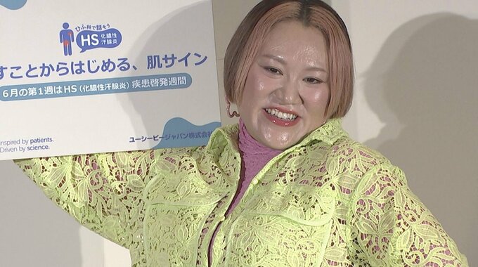 【バービー】出産を経て意識が変化「割く時間が赤ちゃんに向いた」「頑張ることをしなくなりました」|TBS NEWS DIG