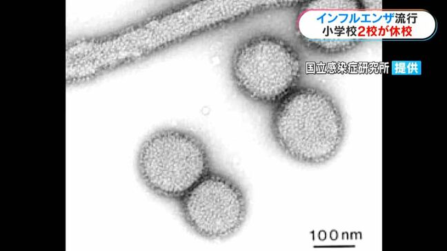 インフルエンザ流行で休校も… 鹿児島県内81校 学年・学級閉鎖|TBS NEWS DIG
