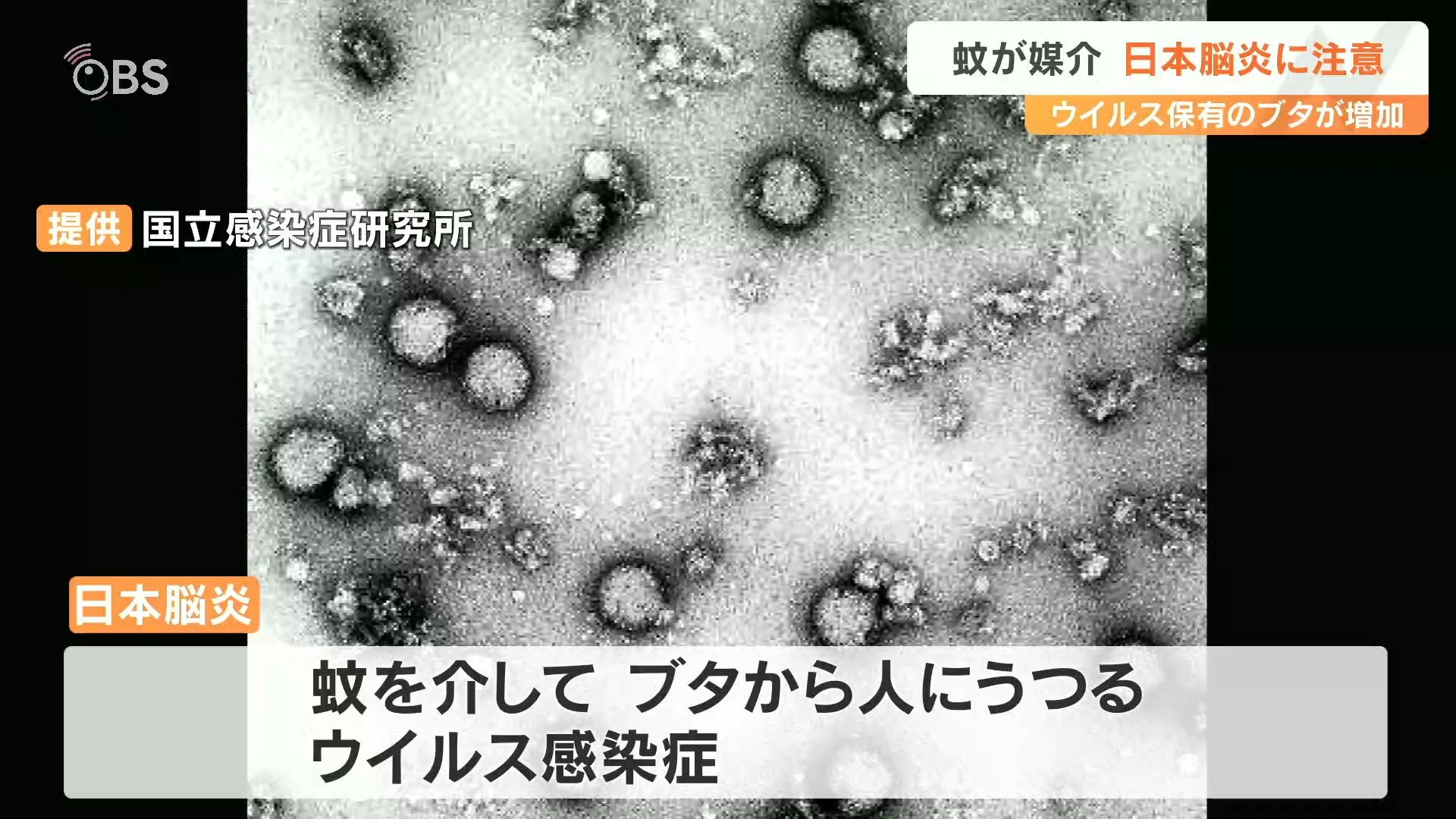 脳炎に伴う合併症にはどのようなものがありますか?