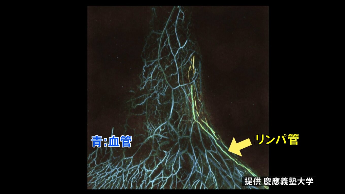  Apple Watchの「世界初の水泳アプリ」が新しいビデオでテストされる