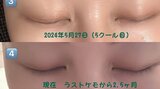 【がんサバイバー】西丸優子さん「マツゲ速報!!」「今は順調に少しずつ生えてきてきます」頭部おしゃれのバケットハットも紹介|TBS NEWS DIG