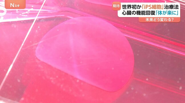 「未来が変わる」iPS細胞由来の心筋細胞シート　大阪大学発企業が厚労省へ承認申請「一日も早く患者に」iPS細胞の実用化近づく|TBS NEWS DIG