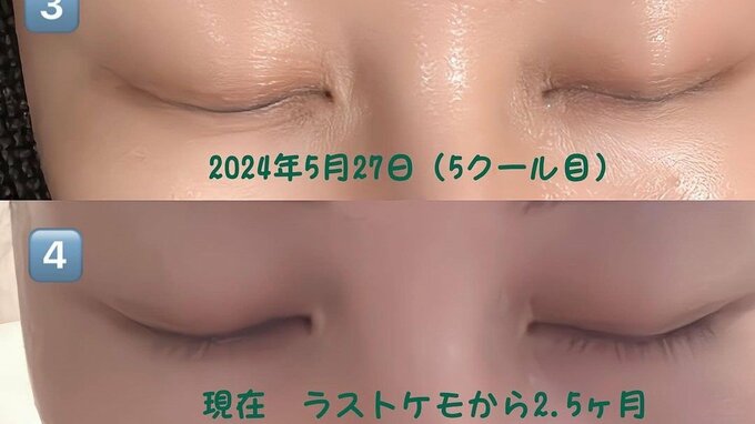 【がんサバイバー】西丸優子さん「マツゲ速報!!」「今は順調に少しずつ生えてきてきます」頭部おしゃれのバケットハットも紹介|TBS NEWS DIG