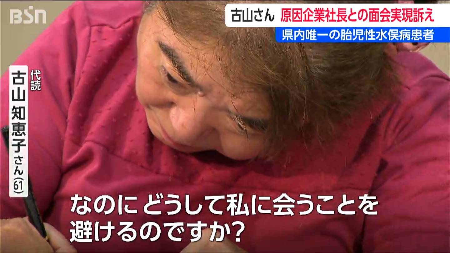胎児性水俣病患者の古山知恵子さん「どうして私に会うことを避けるの