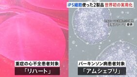 iPS細胞の2製品が世界初の実用化　重症の心不全の患者対象「リハート」・パーキンソン病患者を対象「アムシェプリ」 早ければ夏ごろに実用化|TBS NEWS DIG