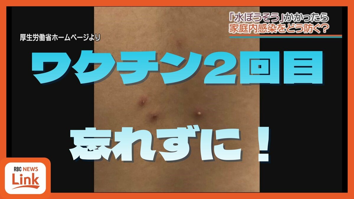 感染力の強い水ぼうそう、家庭内感染を防ぐには？　大人の帯状疱疹からうつるケースも